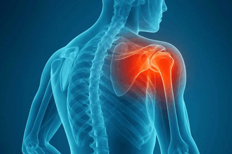 Shoulder Pain